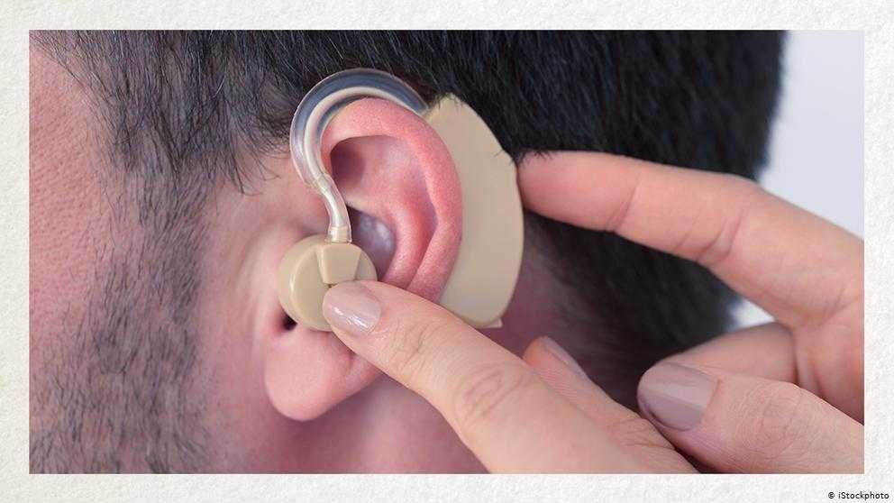 Слуховой аппарат или усилитель слуха: делаем правильный выбор! сравнение усилителей звука со слуховыми аппаратами